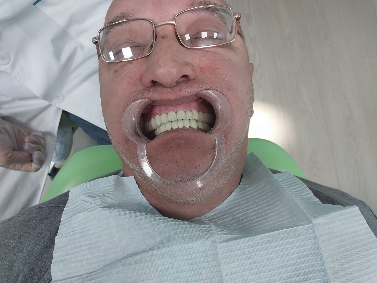 после протезирования зубов в Китае